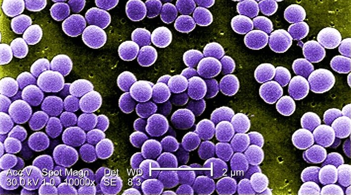 antibioticsStaphylococcus aureus (Public Domain photo by Janice Haney Carr, Matthew J. Arduino, DRPH, USCDCP)