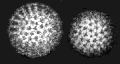 Nuclear magnetic resonance: Viruses viewed under an electron microscope.