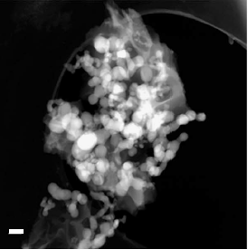 Batteries for electric vehicles, electric cars: STEM Image of anode courtesy of F.M. Hassan.