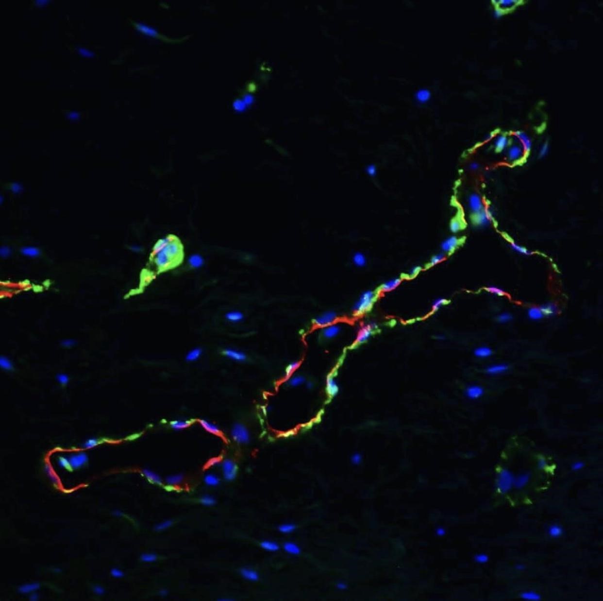 A mature blood vessel. The red fluorescence marker demarcates the outline of a blood vessel. The green fluorescence marker is detecting cells that support the vessel. The blue dots are the nuclei of the cells.