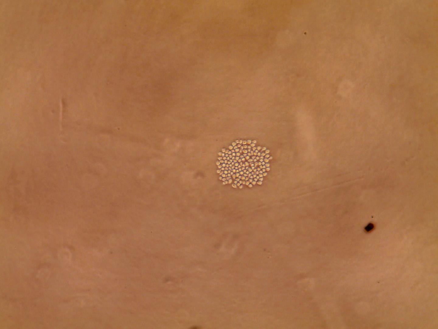 Just one in 2,000 bone marrow cells are hematopoietic stem cells. These are the source of the ten billion blood cells humans make every day. (Photo by Pedro Vizán)