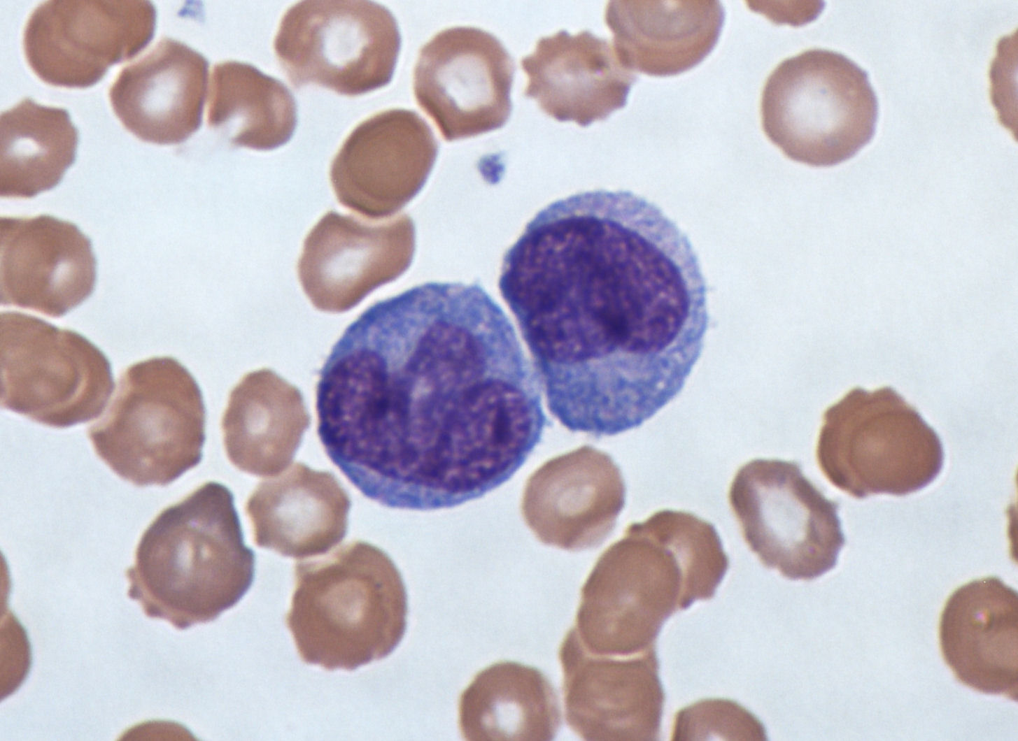 monocytes white blood cells