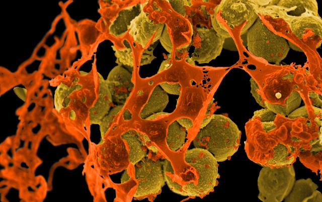 Round yellowish-brown blobs mixed with a web-like orange structure indicating a micrograph of MRSA, the antibiotic-resistant bacteria